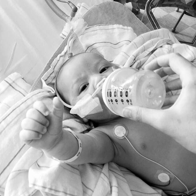 sick baby eating from bottle in hospital
