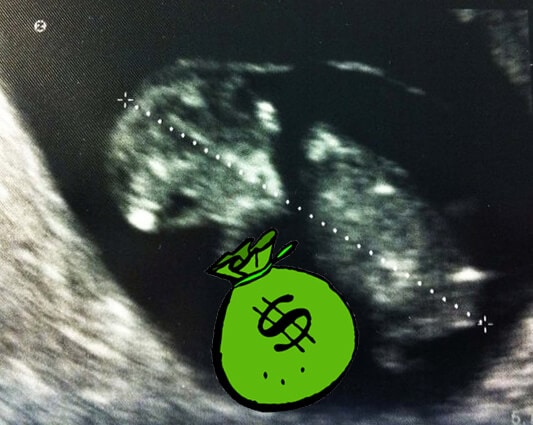 ultrasound-card-money-someday-i-ll-learn